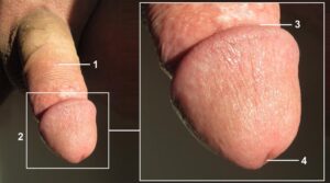 Idealny rozmiar penisa – jaki wybrać, aby czuć się pewnie?