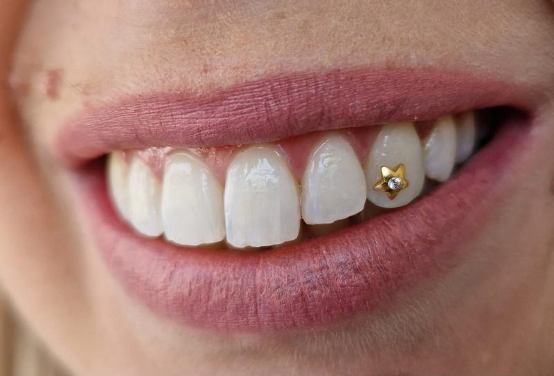 Jak samodzielnie stworzyć biżuterię nazębną – krok po kroku