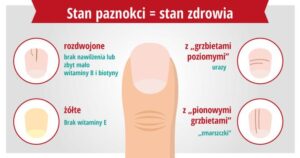 Czy malowanie paznokci może być niebezpieczne dla zdrowia? Oto, co musisz wiedzieć